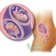 Illustration for article titled She Is Very Small. Her Uterus Doesnt Have The Ability To Hold One, Let Alone Two Children.